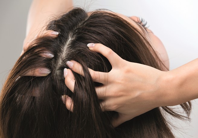 Scalp Tenderness - What's Causing It? || Nizoral